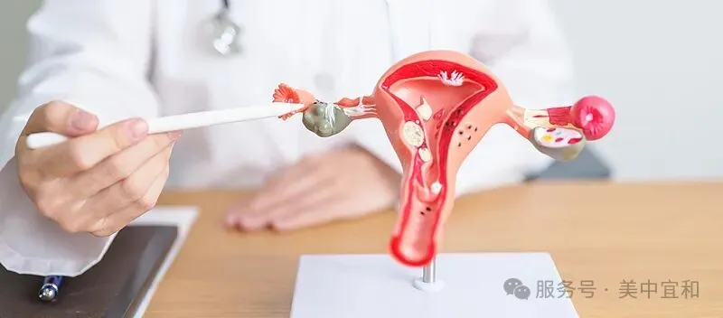 Anatomical model of uterus and adnexa used for patient counseling