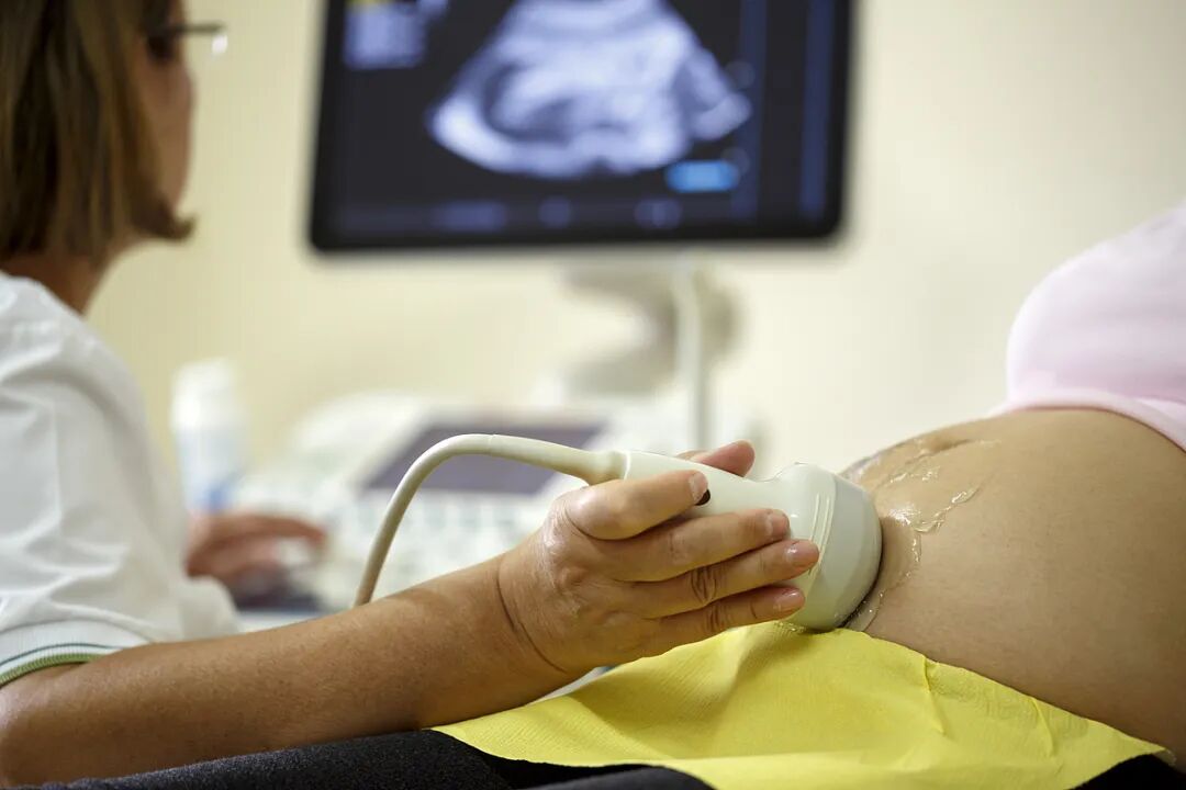 A sonographer performing a prenatal ultrasound scan on an expectant mother at AMCARE Beijing